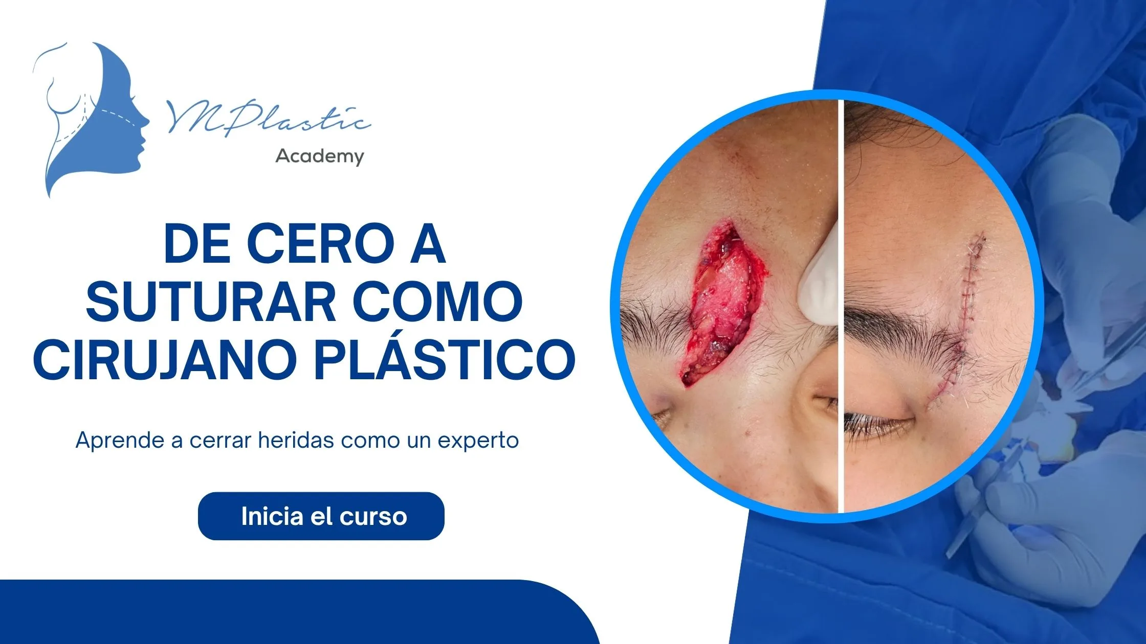 De Cero a Suturar como Cirujano Plástico
